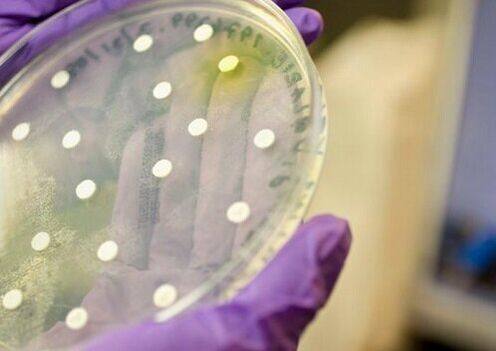 posiew bakteryjny w diagnostyce zapalenia gruczołu krokowego